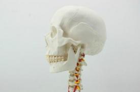 世界颅骨矫形器市场至2023年销售数据为斜头畸形