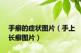 手癣的症状图片（手上长癣图片）