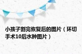 小孩子割完恢复后的图片（环切手术10后水肿图片）
