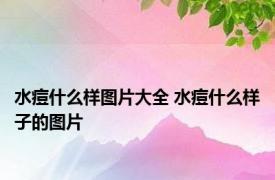 水痘什么样图片大全 水痘什么样子的图片 