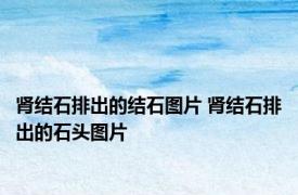 肾结石排出的结石图片 肾结石排出的石头图片 