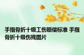 手指骨折十级工伤赔偿标准 手指骨折十级伤残图片 