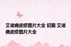 艾滋病皮疹图片大全 初期 艾滋病皮疹图片大全 