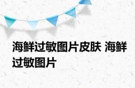海鲜过敏图片皮肤 海鲜过敏图片 