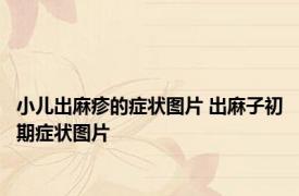 小儿出麻疹的症状图片 出麻子初期症状图片 